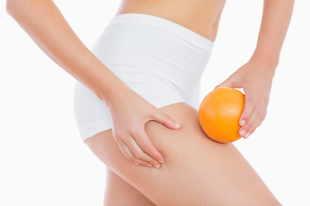 Come eliminare la cellulite: 8 regole fondamentali